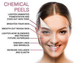 light chemical peels