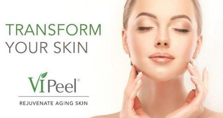 vi peel for medium peels