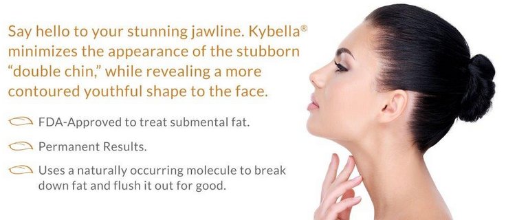 kybella information photo